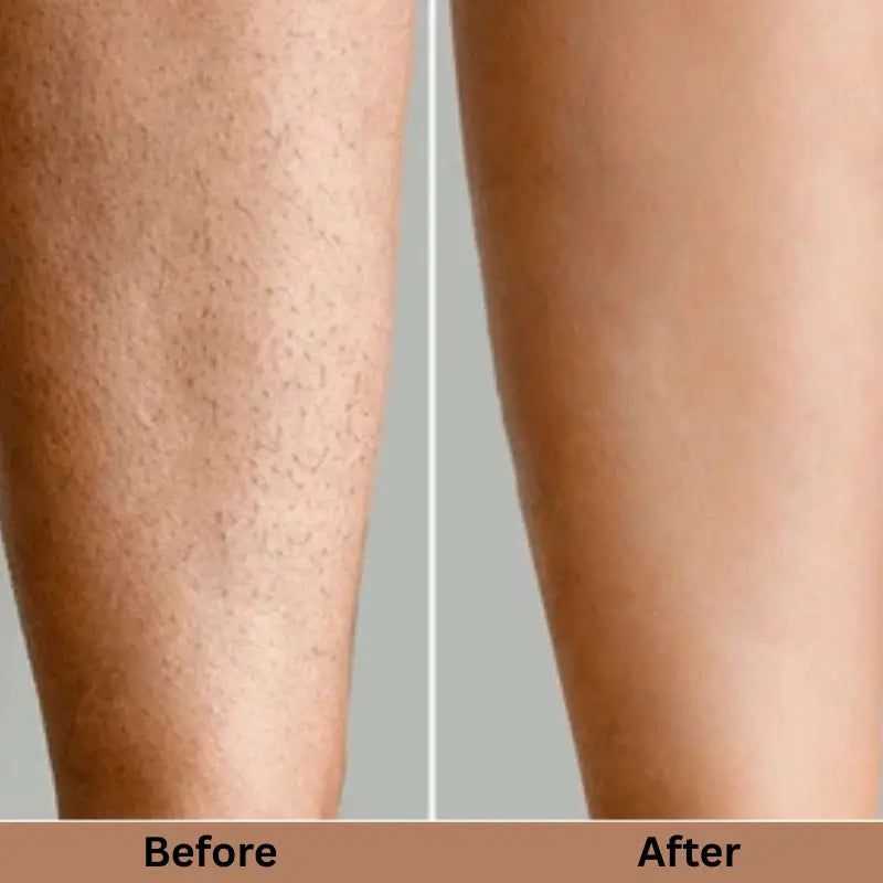 SILKSKINPRO IPL HAIR REMOVAL DEVICE