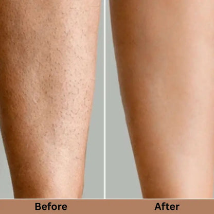 SILKSKINPRO IPL HAIR REMOVAL DEVICE