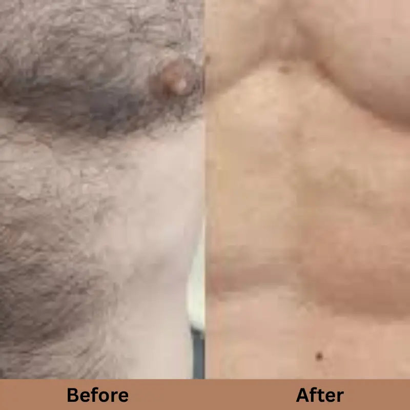 SILKSKINPRO IPL HAIR REMOVAL DEVICE