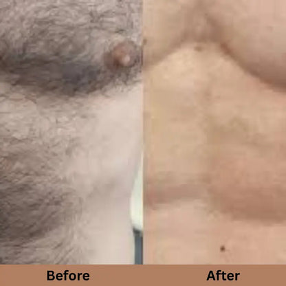 SILKSKINPRO IPL HAIR REMOVAL DEVICE