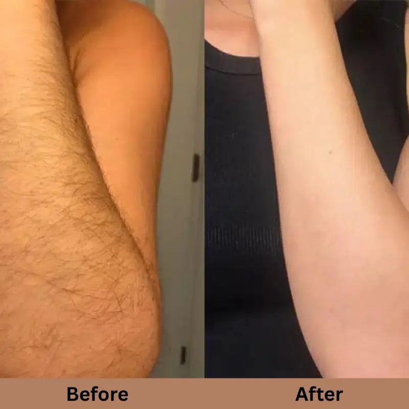 SILKSKINPRO IPL HAIR REMOVAL DEVICE