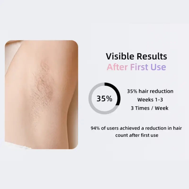 SILKSKINPRO IPL HAIR REMOVAL DEVICE