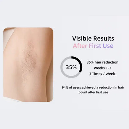 SILKSKINPRO IPL HAIR REMOVAL DEVICE